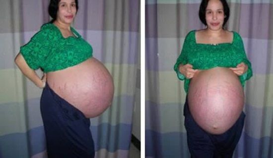 Cực hiếm: Người phụ nữ sinh chín, 5 gái, 4 trai đều khỏe mạnh