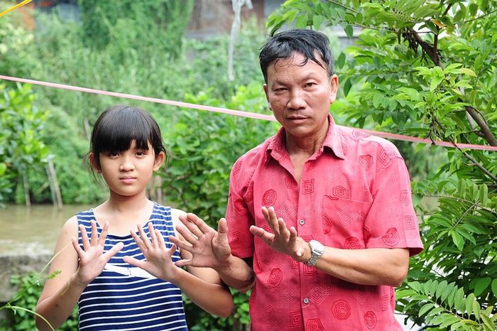 Kỳ lạ gia đình 3 đời đều có 24 ngón tay, chân và nỗi lòng người cha