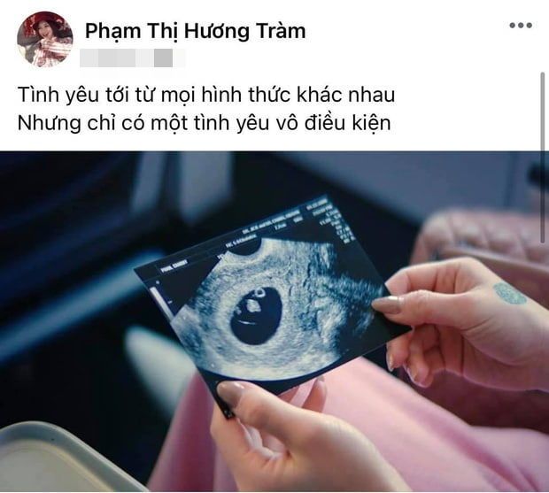 Mỹ nhân Việt sang Mỹ du học, trị bệnh cuối cùng lại thành sinh con