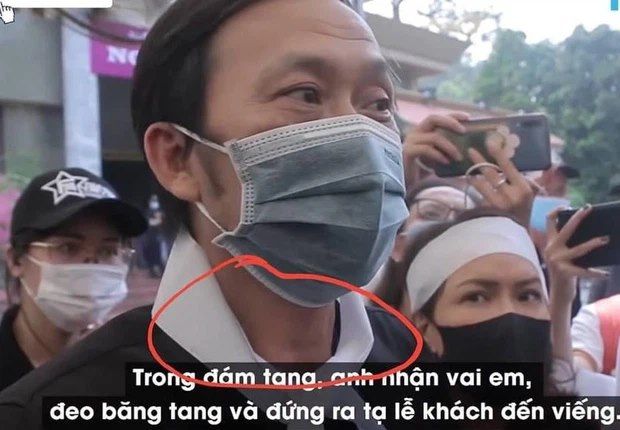 Nghi vấn Hoài Linh xoá ảnh sau khi bị nghi ngờ sẹo mổ là giả