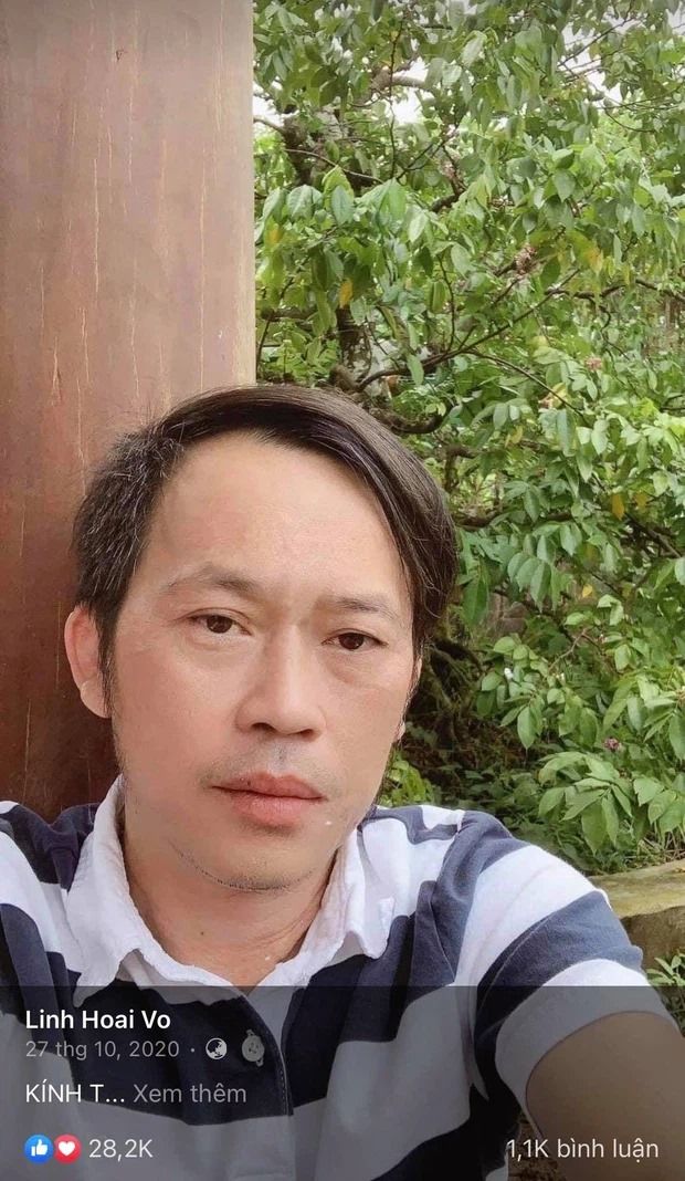 Nghi vấn Hoài Linh xoá ảnh sau khi bị nghi ngờ sẹo mổ là giả