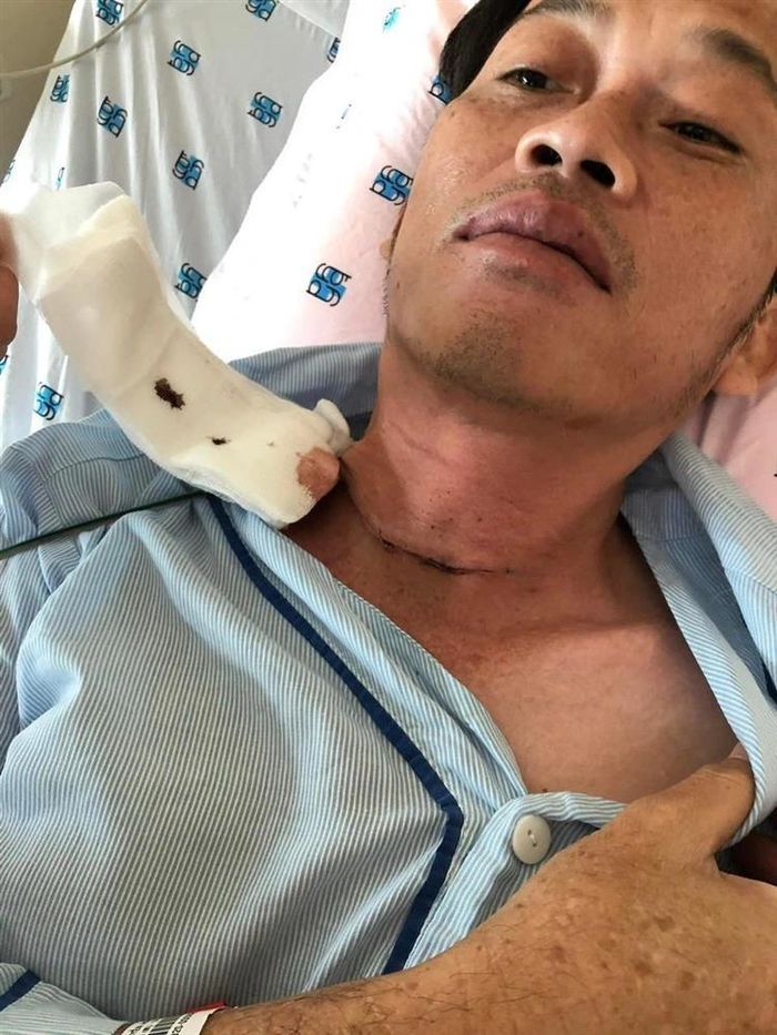 Nghi vấn Hoài Linh xoá ảnh sau khi bị nghi ngờ sẹo mổ là giả