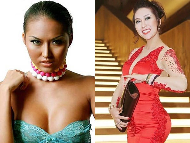 Sao Việt chi tiền khủng để tân trang nhan sắc: 500 triệu chưa là gì