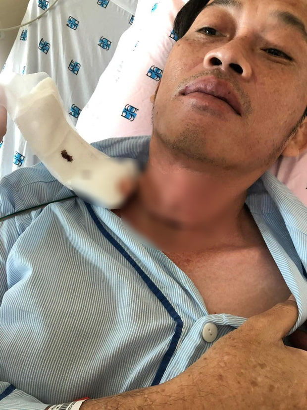 Tình hình Hoài Linh qua lời kể của đàn em hậu ồn ào tiền từ thiện