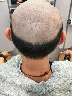 Bà mẹ trị cậu con trai thích ra đường mùa dịch bằng “quả đầu” xấu lạ