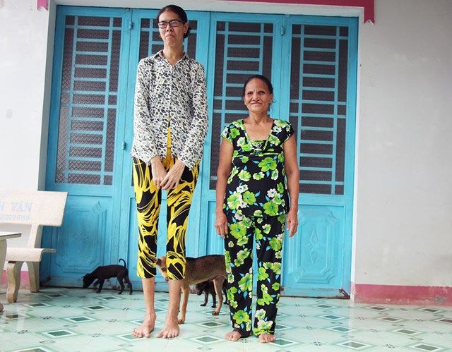 Bất hạnh cuộc đời cô gái cao 2m ở miền Tây: Bị hàng xóm xa lánh