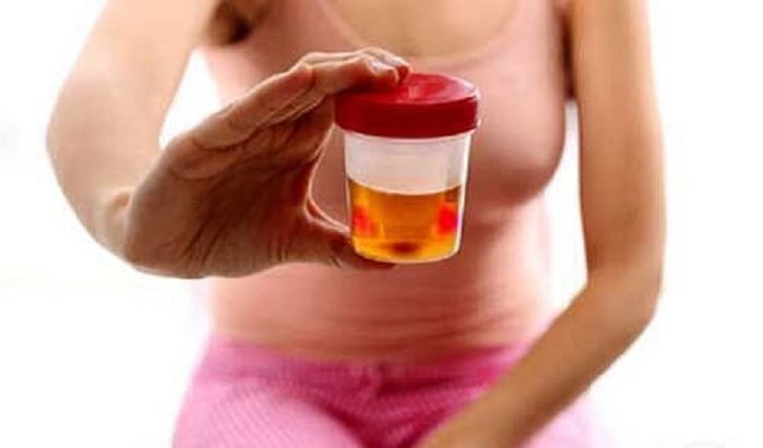 BTV Cẩm Liên qua đời vì nan y thận, chuyên gia chỉ 3 dấu hiệu cần khám