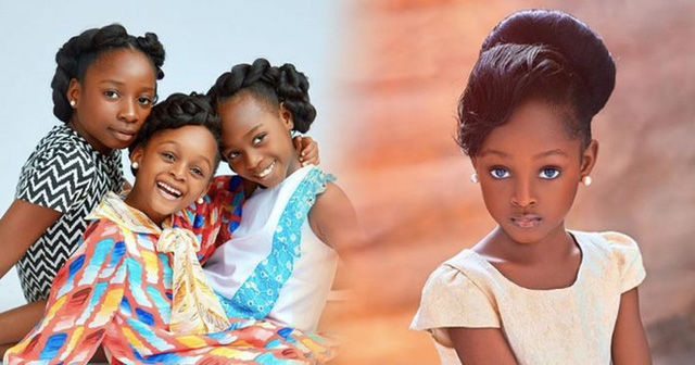 Em bé châu Phi xinh đẹp giờ mặt thay đổi nhiều, thoát cảnh nghèo