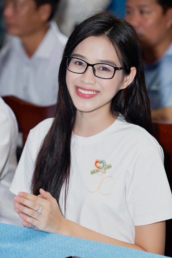 Hết niềng răng, Đỗ Thị Hà tiếp tục tân trang điểm quan trọng trên mặt