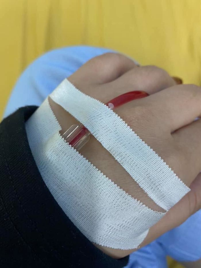 Mất ngủ vì stress kéo dài, cô gái 26 tuổi bị điếc vĩnh viễn 1 bên tai