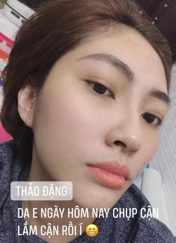 Mỹ nhân Việt tan nát khi mang bầu: Đặng Thu Thảo mụn chi chít