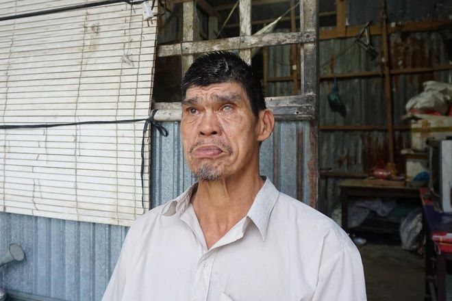 Người đàn ông khổng lồ ở miền Tây giờ mù lòa, bệnh tật đầy mình