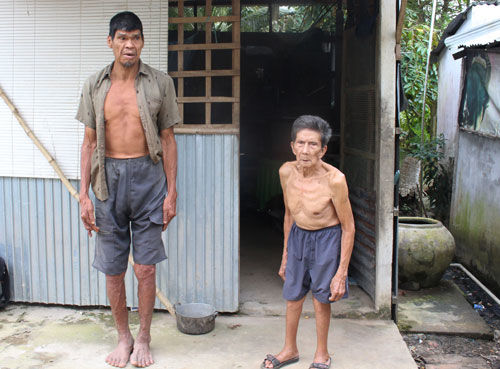 Người đàn ông khổng lồ ở miền Tây giờ mù lòa, bệnh tật đầy mình