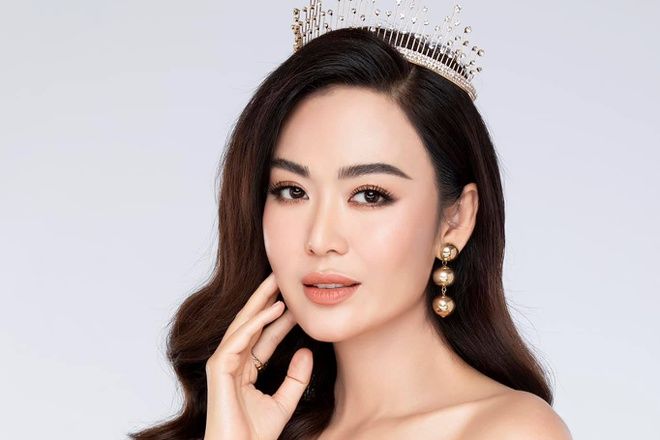 Hoa hậu Thu Thủy qua đời vì đột quỵ: Lưu ý tăng huyết áp, đau đầu