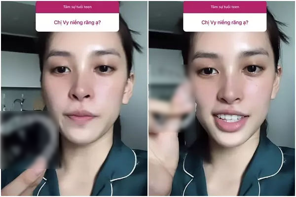 Đẹp không góc chết, Trần Tiểu Vy vẫn chỉnh nhẹ điểm ăn tiền trên mặt
