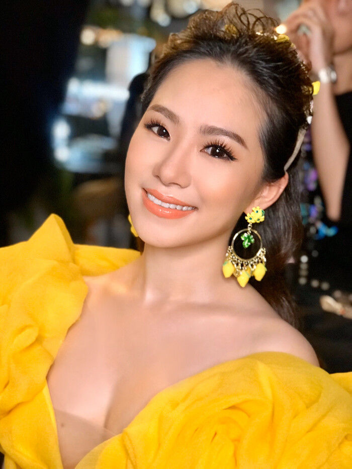 Nữ ca sĩ từng bị bỏng nặng chỉ cách đối mặt với bình luận phản cảm