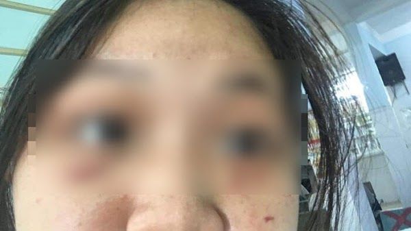 Nữ sinh bị nhóm bạn hội đồng: Phải uống thuốc, tâm lý bất ổn