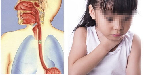 Trẻ nguy kịch khi ăn vải, chuyên gia lưu ý điều bố mẹ không thể bỏ qua