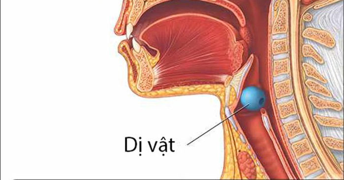 Trẻ nguy kịch khi ăn vải, chuyên gia lưu ý điều bố mẹ không thể bỏ qua