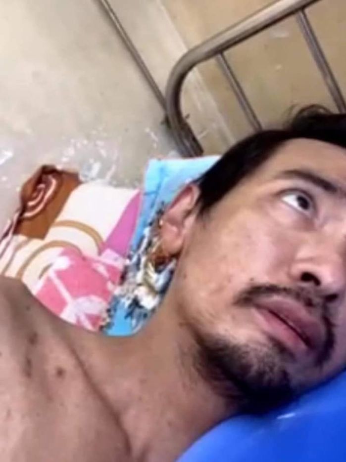 Việt Quang bị bệnh phổi nặng nguy kịch, không đủ kinh phí điều trị