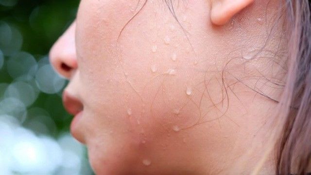 8 dấu hiệu của cơ thể nhắc cần bổ sung gấp vitamin D: Đổ mồ hôi nhiều
