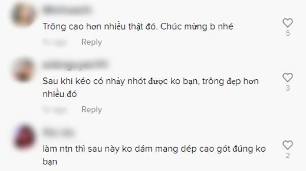 Cô gái giấu bố mẹ kéo chân sau 4 tháng: cao thêm 7cm, tự tin tạo dáng