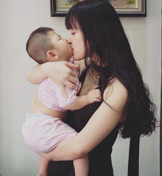 Hình ảnh em bé Lào Cai suy dinh dưỡng sau 5 năm được mẹ 9X nhận nuôi 