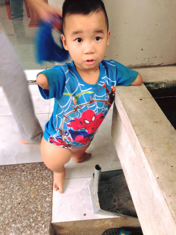 Cậu bé 8 tuổi đến trường bằng đôi tay rướm máu, mơ ước có đôi chân giả