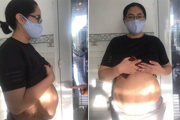 Nỗi niềm sao Việt khi sinh nở: Người phải lết đi, người mụn chi chít
