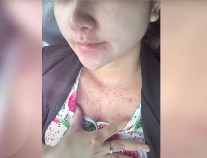 Nỗi niềm sao Việt khi sinh nở: Người phải lết đi, người mụn chi chít