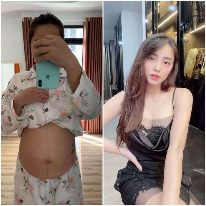 Nỗi niềm sao Việt khi sinh nở: Người phải lết đi, người mụn chi chít