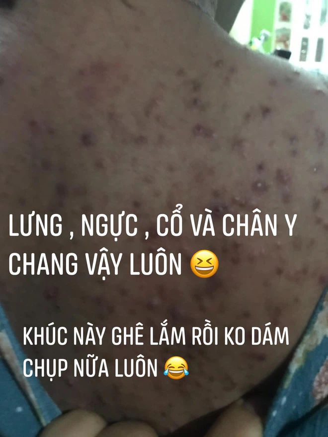 Nỗi niềm sao Việt khi sinh nở: Người phải lết đi, người mụn chi chít