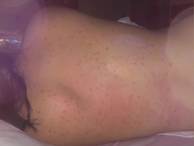 Nỗi niềm sao Việt khi sinh nở: Người phải lết đi, người mụn chi chít