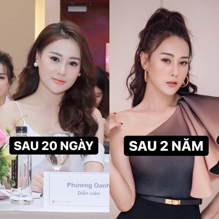 Phương Oanh của Hương vị tình thân: Xinh đẹp nhờ dao kéo
