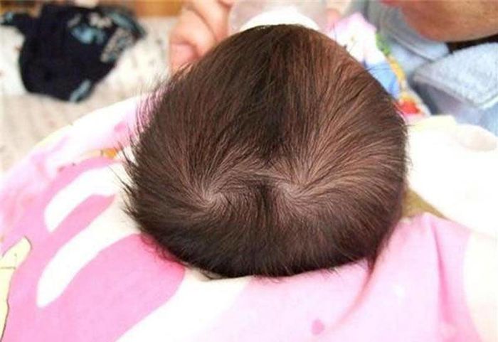 Theo Nhân tướng học: Sở hữu 2 xoáy là mẫu người yêu cực lý tưởng