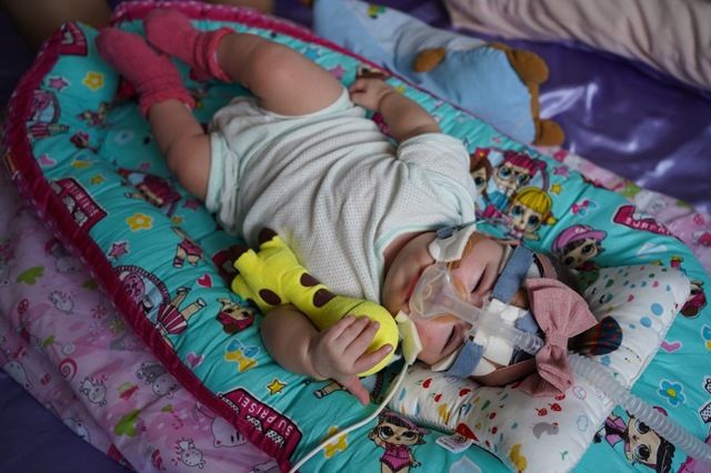 Sau 13 tháng nằm viện, bé sinh non nhỏ nhất thế giới đã được về nhà