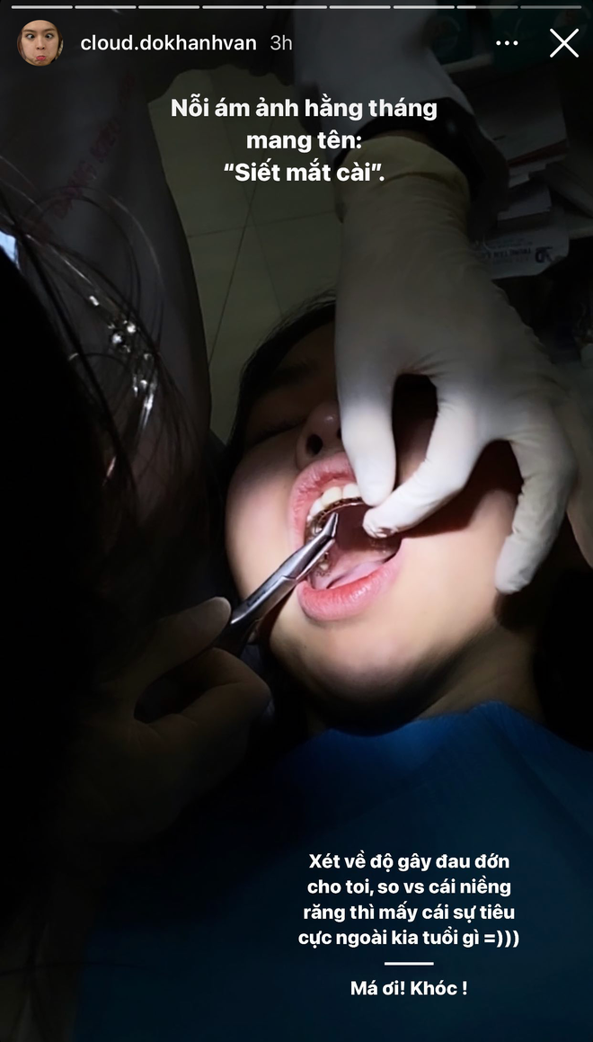 Sao Việt nâng tầm nhan sắc nhờ chỉnh răng, có người còn thành Hoa hậu
