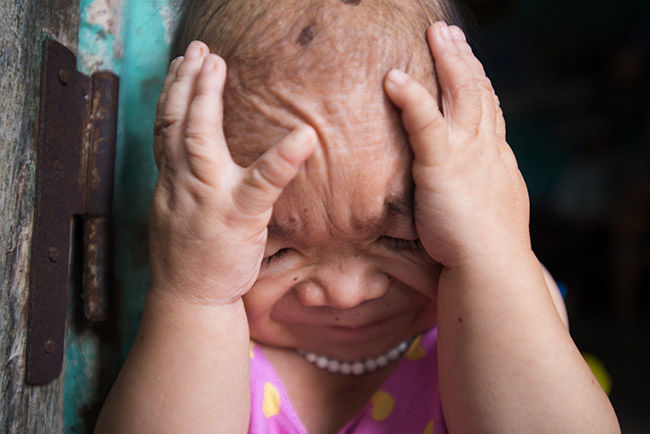 Mẹ già nuôi con gái không bao giờ lớn: 31 năm vẫn hình hài 1 đứa trẻ