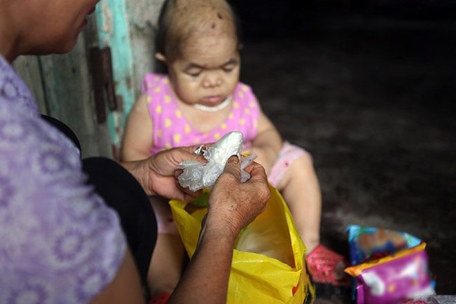 Mẹ già nuôi con gái không bao giờ lớn: 31 năm vẫn hình hài 1 đứa trẻ