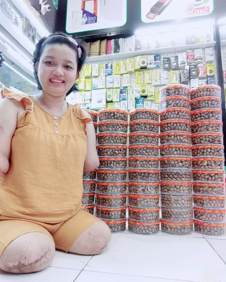 Người mẹ chấp nhận tháo tứ chi để giữ mạng nuôi con