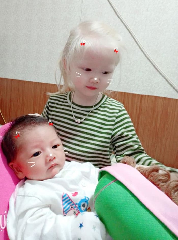 Mẹ Việt ở Nghệ An sinh con tóc vàng như em bé lai, BS bảo đột biến gen