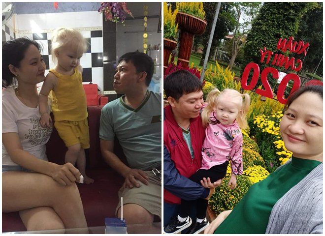 Mẹ Việt ở Nghệ An sinh con tóc vàng như em bé lai, BS bảo đột biến gen