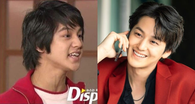 Sao Hàn lên đời nhờ chỉnh răng: Kim Bum hóa nam thần cười tỏa nắng