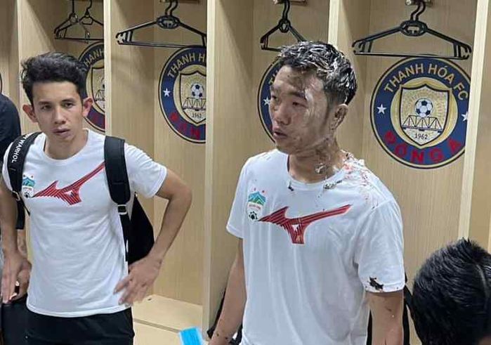 1001 biểu cảm của sao khi bị trét bánh kem: Sơn Tùng mất vẻ điển trai