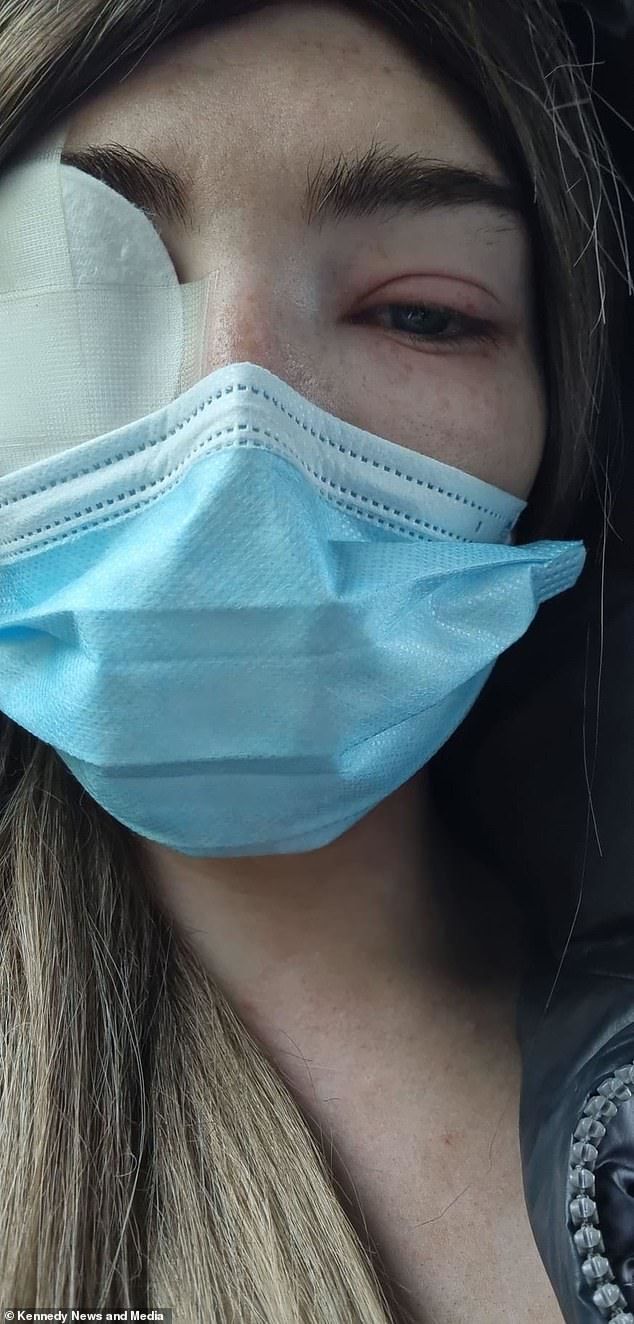 Cô gái chi 1,4 triệu nối mi kiểu búp bê Nga, sau 2 ngày mí dính chặt