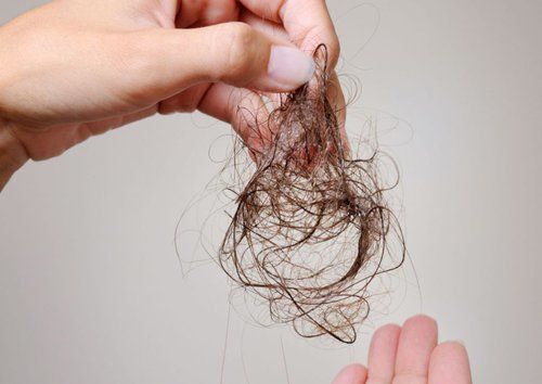 Gội đầu mấy lần/tuần là đủ, nhiều người làm sai khiến tóc rụng xơ xác