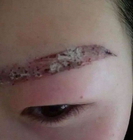 Pha xăm chân mày sai một li đi một dặm: vừa buồn cười vừa thương