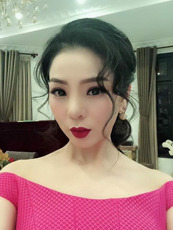 Sao Việt đúng đắn khi sửa mũi: cứu cả gương mặt, sự nghiệp phất lên