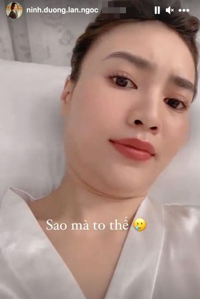 Sao Việt và nỗi ánh ảnh mang tên nọng cằm: Do thói quen tích mỡ