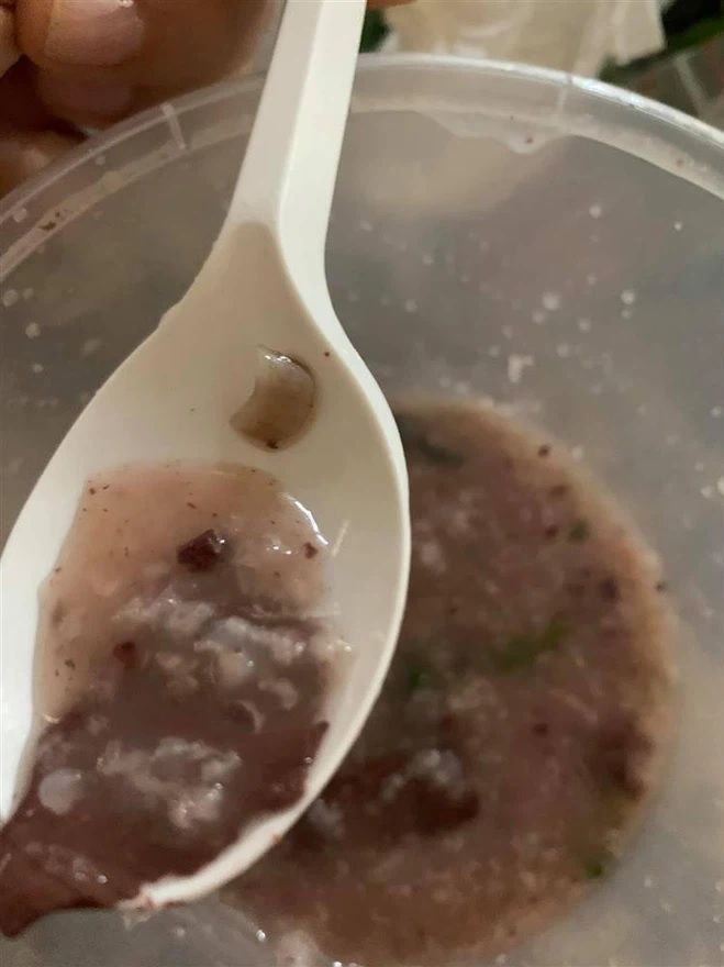 Cô gái order đồ ăn về phát hiện vật thể lạ như giấy vệ sinh
